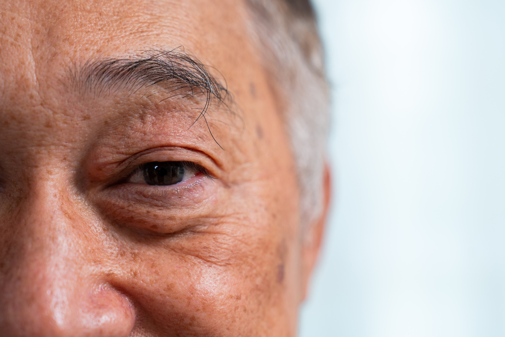 chirurgia della cataratta