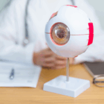 vasculopatia coroideale polipoidale