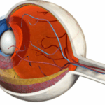 maculopatia essudativa polipoide