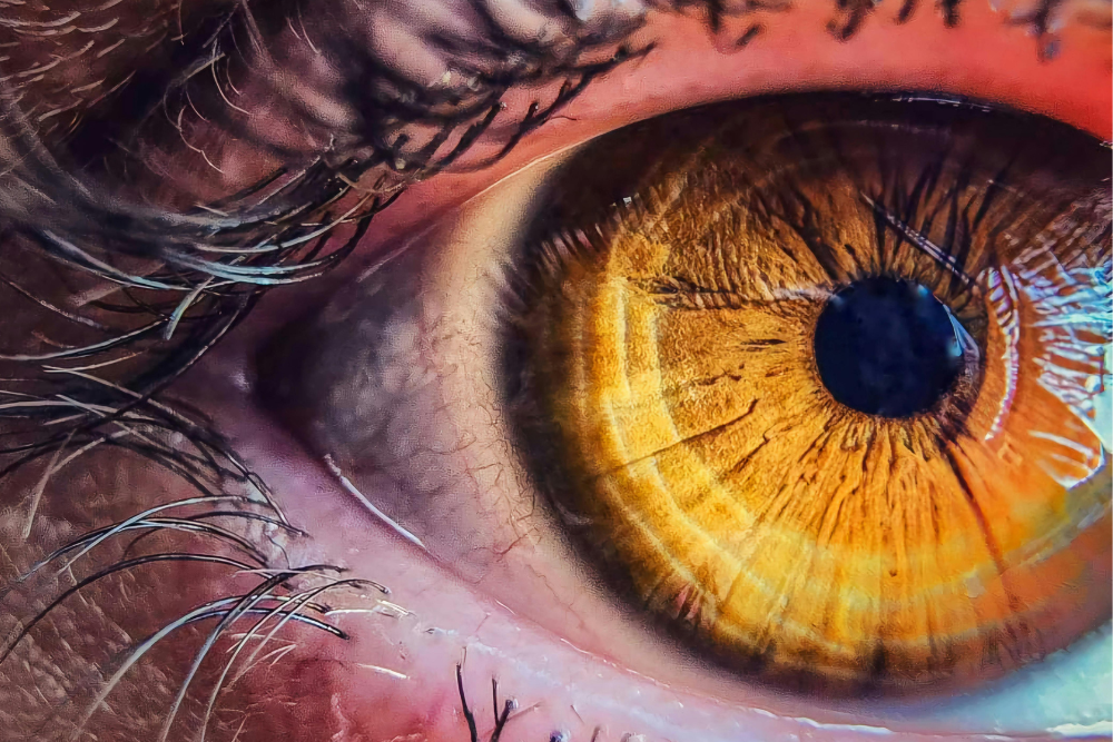 protocollo vision